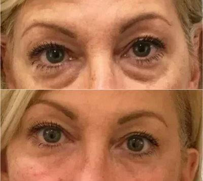 Valérie D., 58 ans
