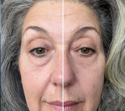 Isabelle M., 56 ans