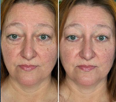 Catherine P., 54 ans
